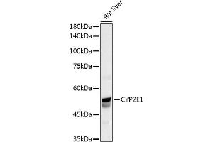 Western blot analysis of extracts of Rat liver, using CYP2E1 Rabbit pAb antibody (ABIN3023078, ABIN3023079, ABIN3023080 and ABIN6219379) at 1:1000 dilution. (CYP2E1 anticorps  (AA 234-493))