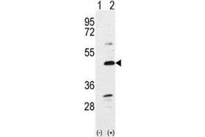 Western blot analysis of BMP7 antibody and 293 cell lysate either nontransfected (Lane 1) or transiently transfected with the BMP7 gene (2).