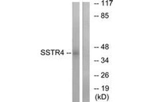 Western blot analysis of extracts from LOVO cells, using SSTR4 Antibody. (SSTR4 anticorps  (AA 155-204))