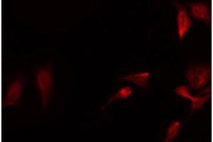 ABIN6267640 staining Hela by IF/ICC.