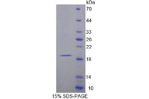 SDS-PAGE analysis of Rat MARCO Protein. (MARCO Protéine)
