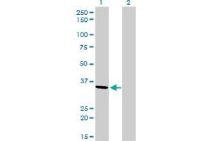 Western Blot analysis of AKR7A2 expression in transfected 293T cell line by AKR7A2 monoclonal antibody (M01), clone 2A6.