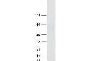 Validation with Western Blot