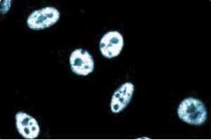 Immunoflourescence staining of human endothelial cells. (CG7626 Gene Product From Transcript CG7626-RA (SPT5) (AA 866-985) anticorps)