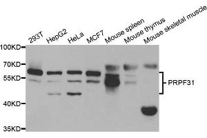 Western blot analysis of extracts of various cell lines, using PRPF31 antibody. (PRPF31 anticorps)