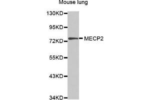 Western Blotting (WB) image for anti-Methyl CpG Binding Protein 2 (MECP2) (AA 1-280) antibody (ABIN5663752) (MECP2 anticorps  (AA 1-280))