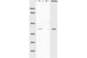 Lane 1: mouse brain lysates Lane 2: mouse embryo lysates probed with Anti PAR-2 Polyclonal Antibody, Unconjugated (ABIN738816) at 1:200 in 4 °C. (NR1I2 anticorps  (AA 101-150))