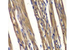 Immunohistochemistry of paraffin-embedded Rat heart using PTPN2 Polyclonal Antibody at dilution of 1:100 (40x lens). (PTPN2 anticorps)