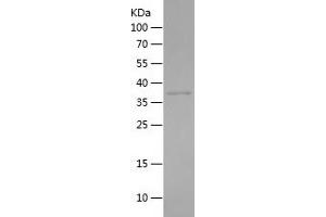 Western Blotting (WB) image for Aldo-Keto Reductase Family 1, Member E2 (AKR1E2) (AA 201-320) protein (His-IF2DI Tag) (ABIN7121786) (AKR1E2 Protein (AA 201-320) (His-IF2DI Tag))