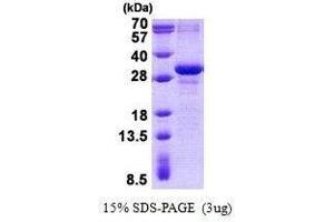 Figure annotation denotes ug of protein loaded and % gel used. (MXD3 Protéine)
