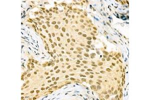 Immunohistochemistry of paraffin embedded mouse bladder using PABPN1 (ABIN7075116) at dilution of 1:600 (400x lens) (PABPN1 anticorps)