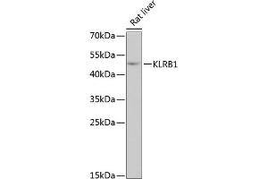 Western blot analysis of extracts of rat liver, using KLRB1 antibody (ABIN6130055, ABIN6142970, ABIN6142972 and ABIN6222669) at 1:3000 dilution.