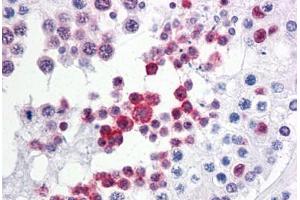 anti-TP53 Regulating Kinase (TP53RK) (AA 1-254) antibody