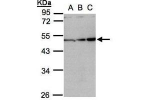 WB Image Sample(30 ug whole cell lysate) A:H1299 B:HeLa S3, C:Hep G2 , 10% SDS PAGE antibody diluted at 1:1000