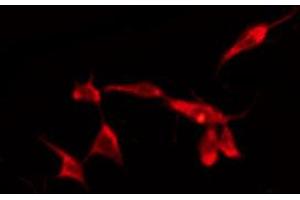 ABIN6274608 staining HepG2 by IF/ICC. (CADM2 anticorps  (Internal Region))