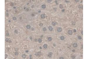 Detection of C5a in Mouse Liver Tissue using Monoclonal Antibody to Complement Component 5a (C5a)