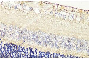 Immunohistochemistry of paraffin-embedded Rat retina using GRK1 Polyclonal Antibody at dilution of 1:200 (40x lens).