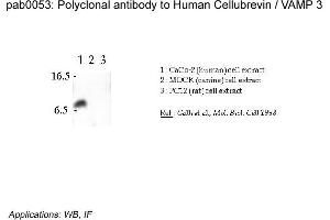 Image no. 2 for anti-Vesicle-Associated Membrane Protein 3 (VAMP3) (N-Term) antibody (ABIN347002) (VAMP3 anticorps  (N-Term))