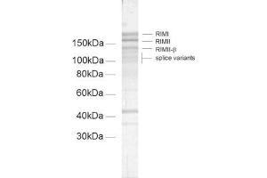 dilution: 1 : 100, sample: crude synaptic membranes fraction of rat brain (LP1)