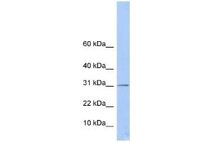 WB Suggested Anti-ECHDC1 Antibody Titration:  0. (ECHDC1 anticorps  (Middle Region))