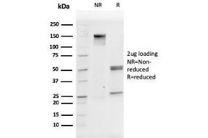 SDS-PAGE Analysis Purified CD31 Mouse Monoclonal Antibody (PECAM1/3527). (CD31 anticorps  (AA 625-738))
