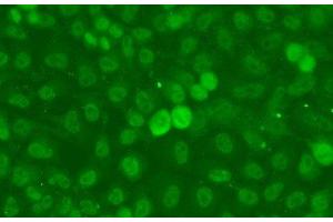 anti-Sjogren Syndrome Nuclear Autoantigen 1 (SSNA1) antibody