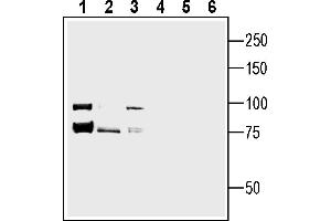 1-3. (Cadherin 13 anticorps  (Extracellular, N-Term))