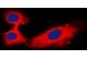 Immunofluorescent analysis of Rabphilin 3A staining in Hela cells. (RPH3A anticorps)