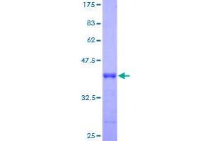 Image no. 1 for Hepatitis B Virus X-Interacting Protein (HBXIP) (AA 83-173) protein (GST tag) (ABIN1306405)