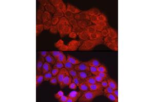Immunofluorescence analysis of  cells using [KO Validated] SCD Rabbit pAb (ABIN7270589) at dilution of 1:150 (40x lens). (SCD anticorps  (C-Term))