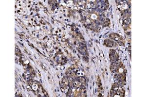 IHC analysis of EXOSC3 using anti-EXOSC3 antibody (ABIN7602216).