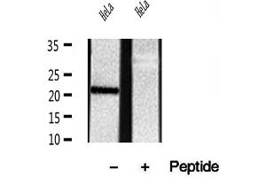 Western blot analysis of extracts of HeLa cells, using REEP5 antibody. (REEP5 anticorps  (N-Term))