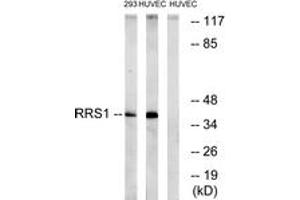 Western blot analysis of extracts from HuvEc/293 cells, using RRS1 Antibody. (RRS1 anticorps  (AA 254-303))