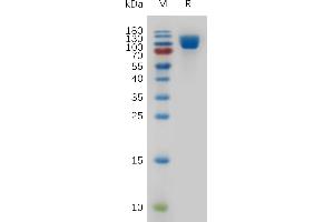 Human CD106 Protein, His Tag on SDS-PAGE under reducing condition.