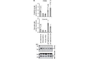 MEF2B-V5 expression alters the abundance of protein from target genes and increases HEK293A cell migration. (Vimentin anticorps)