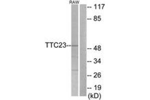 Western blot analysis of extracts from RAW264. (TTC23 anticorps  (AA 341-390))