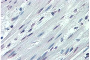 Anti-ITGA3 / CD49c antibody  ABIN960785 IHC staining of human colon, smooth muscle. (ITGA3 anticorps  (N-Term))