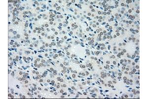 Immunohistochemical staining of paraffin-embedded pancreas tissue using anti-MAP2K4mouse monoclonal antibody.