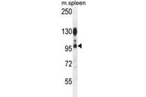 ACAP1 Antibody (N-term) western blot analysis in mouse spleen tissue lysates (35 µg/lane). (ACAP1 anticorps  (N-Term))