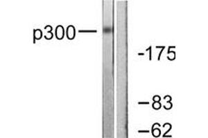 Western blot analysis of extracts from MDA-MB-435 cells, using p300 Antibody. (p300 anticorps  (AA 1-50))