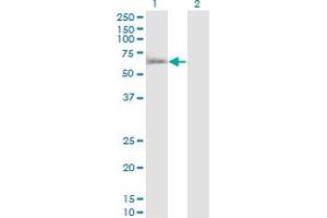 Western Blot analysis of RUVBL1 expression in transfected 293T cell line by RUVBL1 monoclonal antibody (M01), clone 3G4-1F8. (RUVBL1 anticorps  (AA 1-456))