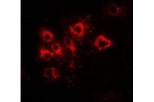 Immunofluorescent analysis of Tapasin staining in Hela cells.
