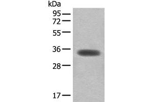 Western blot analysis of Mouse skeletal muscle tissue lysate using MYOZ2 Polyclonal Antibody at dilution of 1:450 (MYOZ2 anticorps)