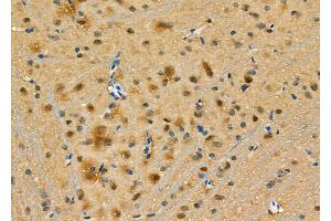 ABIN6264394 and ABIN6276951 at 1/100 staining Rat brain tissue by IHC-P.