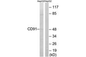 Western blot analysis of extracts from HepG2 cells, using CD91 (Ab-4520) Antibody.