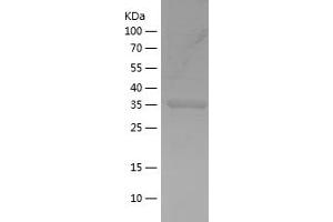 Western Blotting (WB) image for FYN Oncogene Related To SRC, FGR, YES (FYN) (AA 41-190) protein (His-IF2DI Tag) (ABIN7123023)