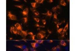 Immunofluorescence analysis of C6 cells using SSTR2 Polyclonal Antibody at dilution of 1:100 (40x lens).