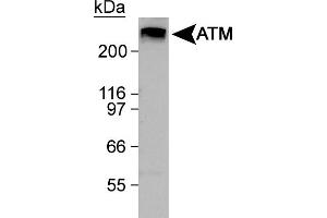Image no. 4 for anti-Ataxia Telangiectasia Mutated (ATM) (C-Term) antibody (ABIN363380)