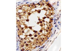 Immunohistochemical analysis of paraffin-embedded H. (FLT4 anticorps  (AA 1-439))
