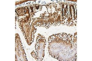 IHC analysis of NR1I2 using anti-NR1I2 antibody (ABIN7602331).